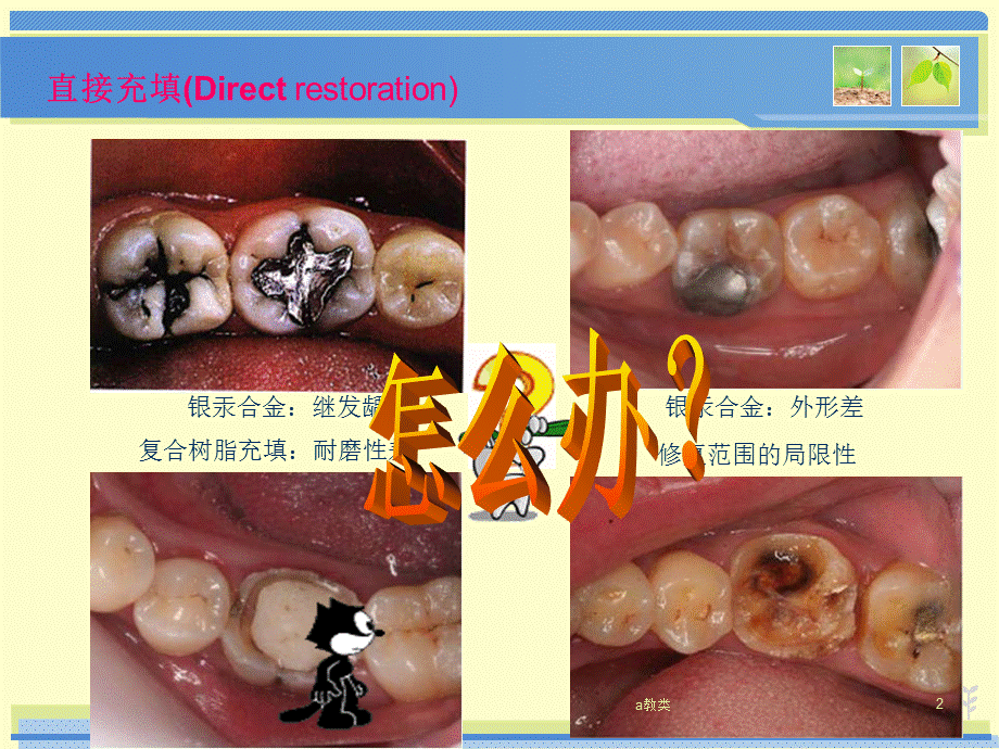 嵌体的制作方法和分类[A类基础].ppt_第2页