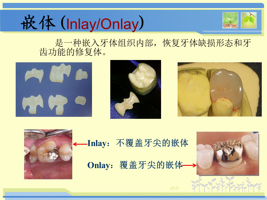 嵌体的制作方法和分类[A类基础].ppt_第3页