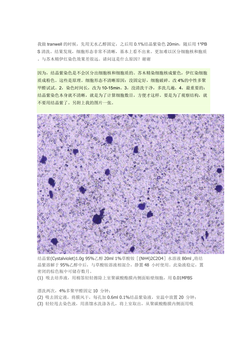 结晶紫染色 细胞形态不清晰.doc_第1页