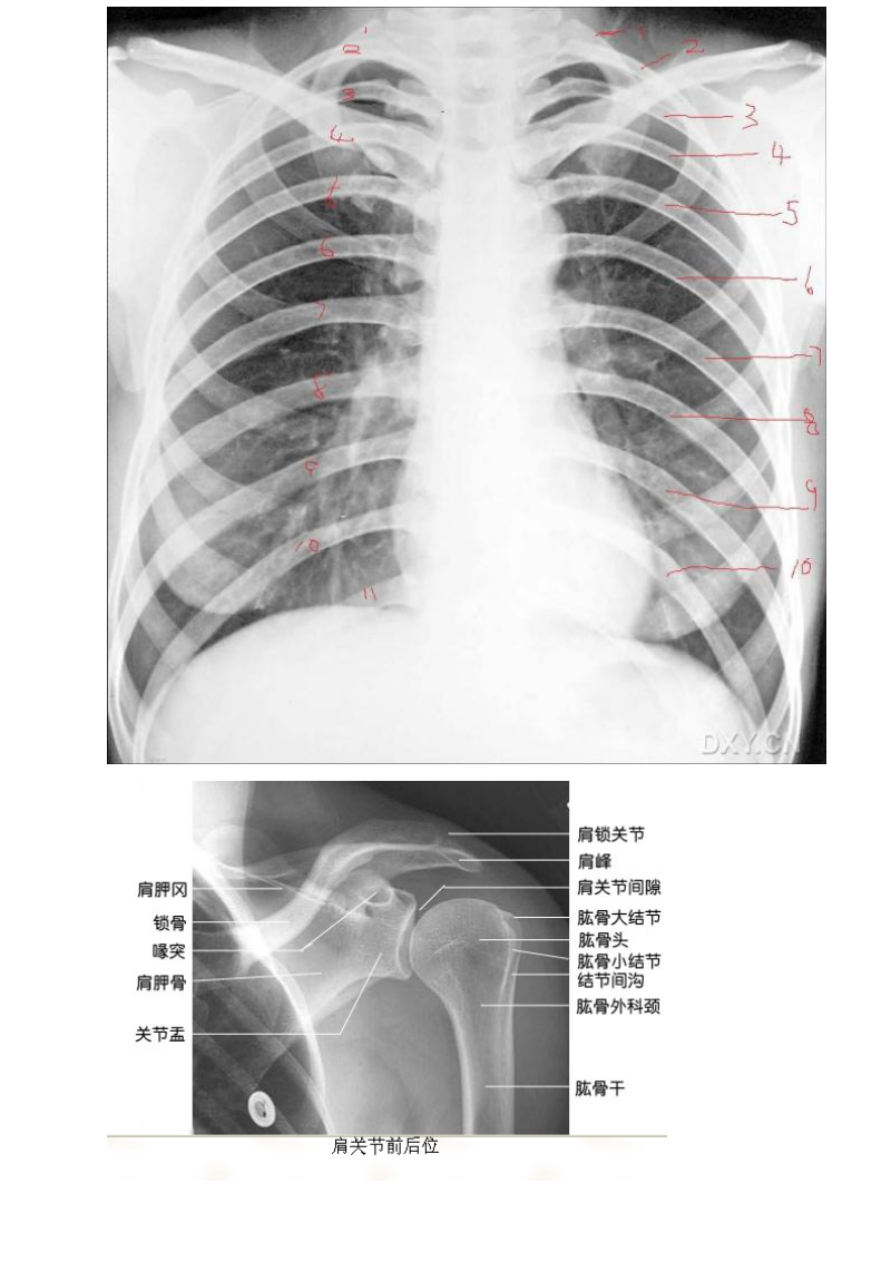 正常X线影像.doc_第2页