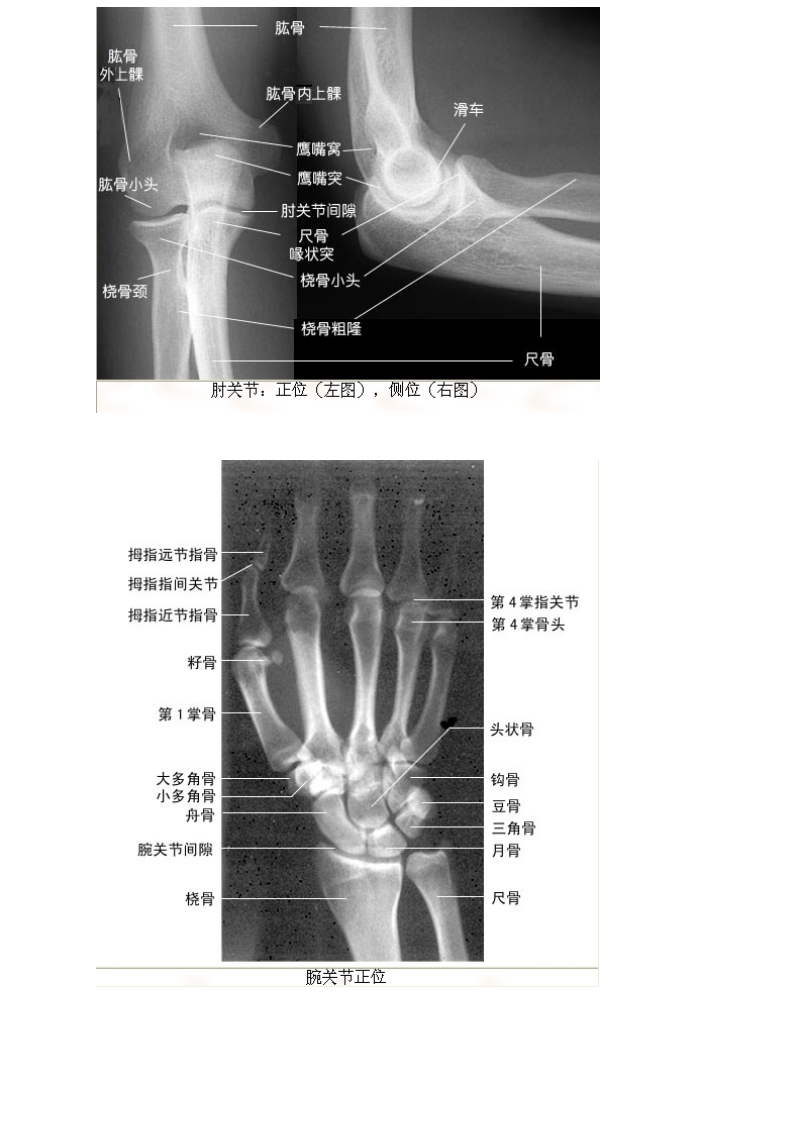 正常X线影像.doc_第3页