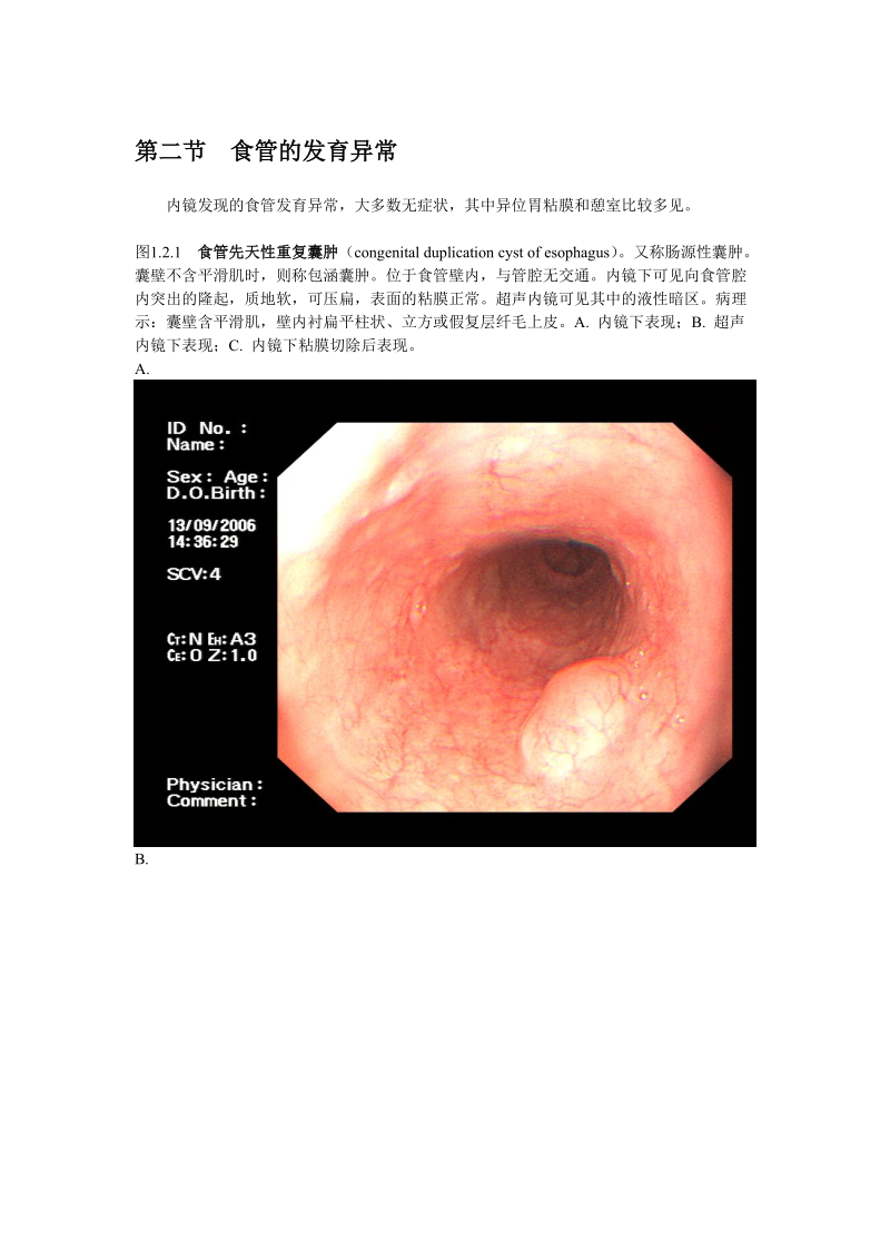 消化内镜诊断图谱食管的发育异常.doc_第1页