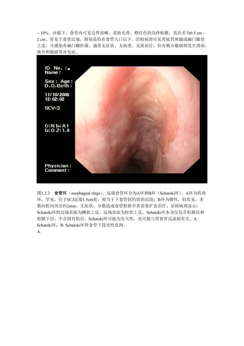 消化内镜诊断图谱食管的发育异常.doc_第3页