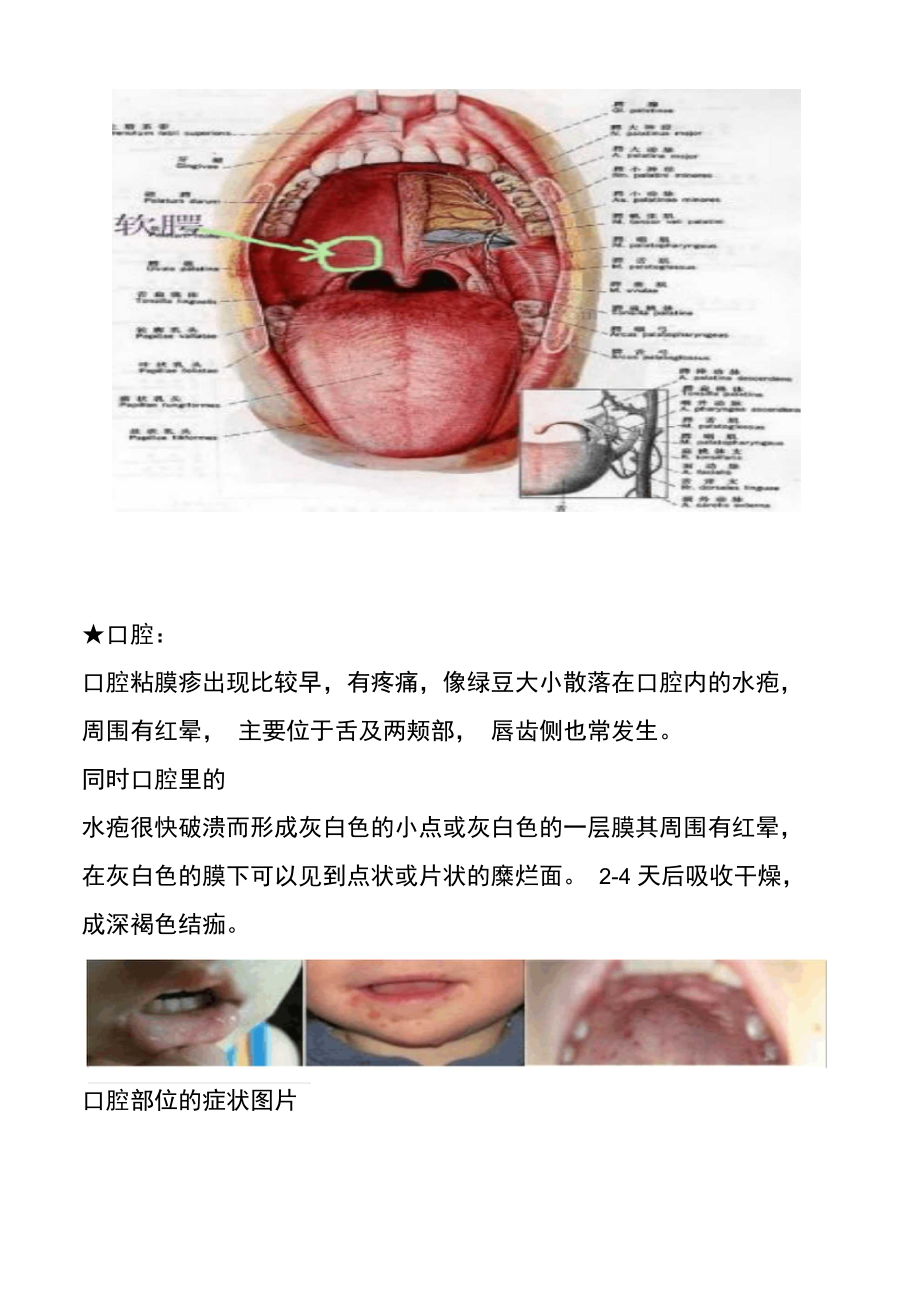 普通手足口病基本的症状为.doc_第2页