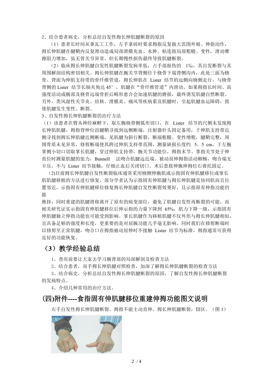 自发性拇长伸肌腱断裂-临床教学查房教案分享.doc_第2页