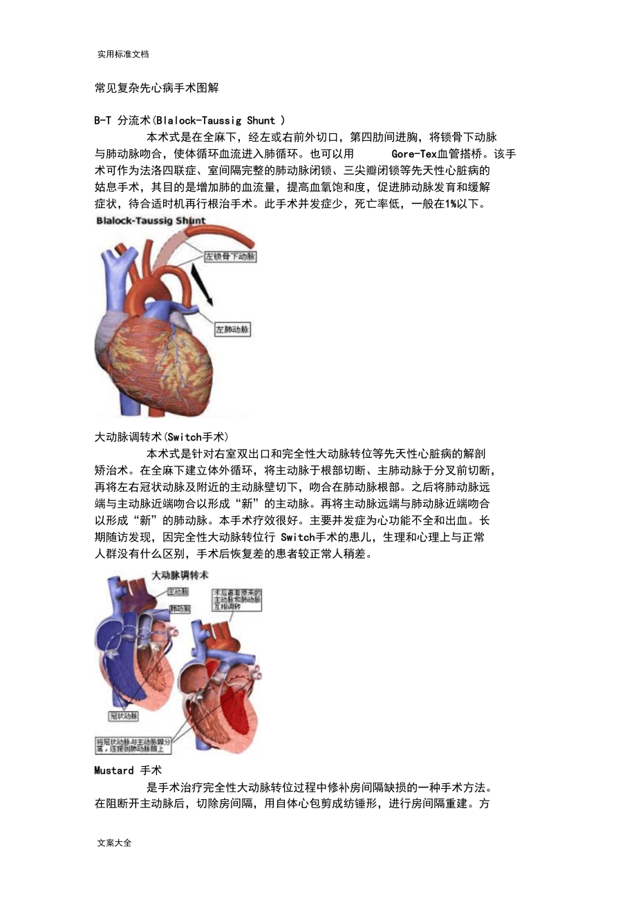 常见复杂先心病手术现用图解.docx_第1页