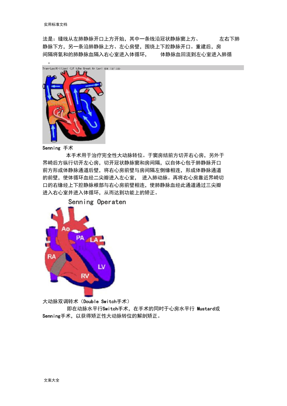 常见复杂先心病手术现用图解.docx_第2页