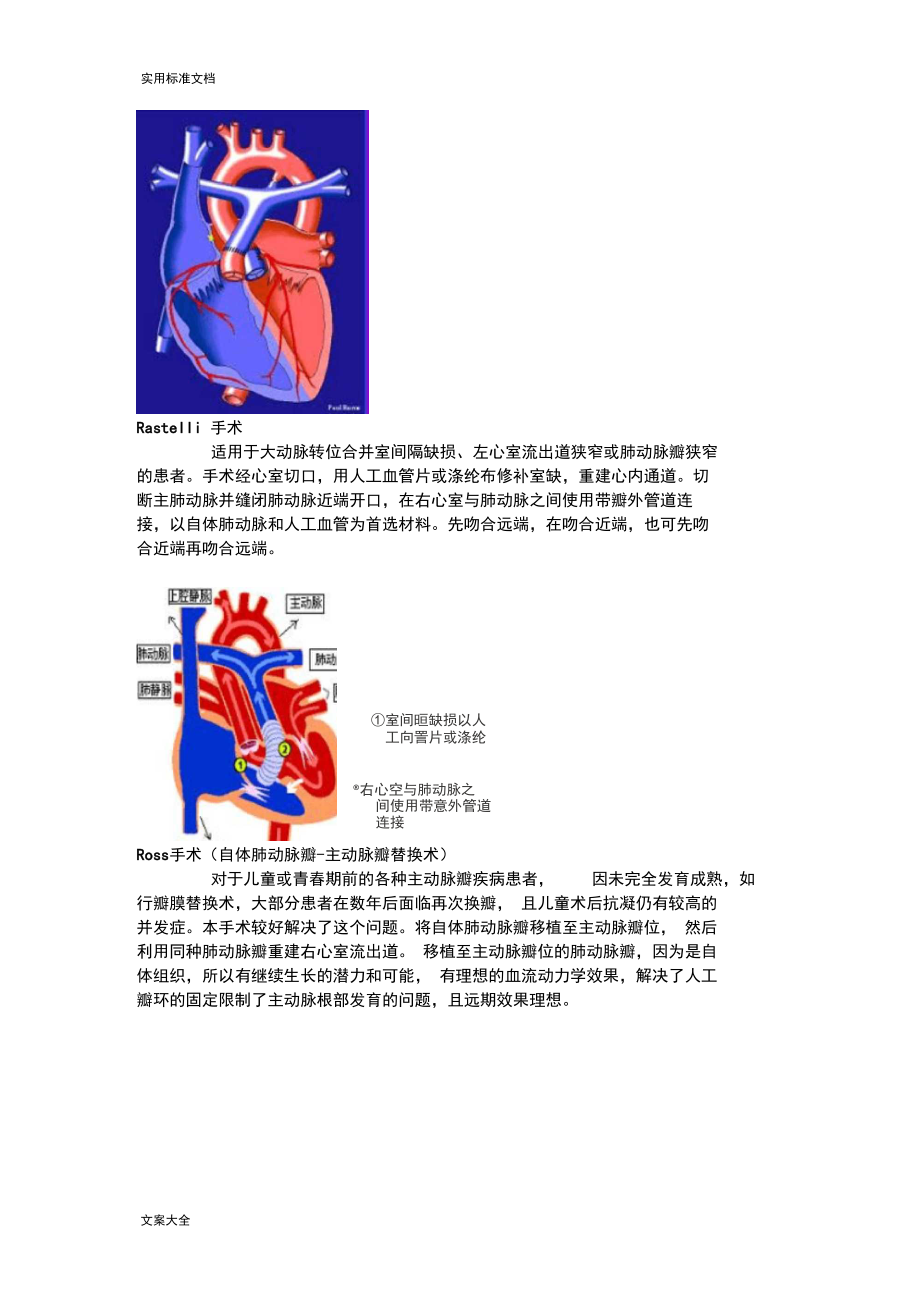 常见复杂先心病手术现用图解.docx_第3页