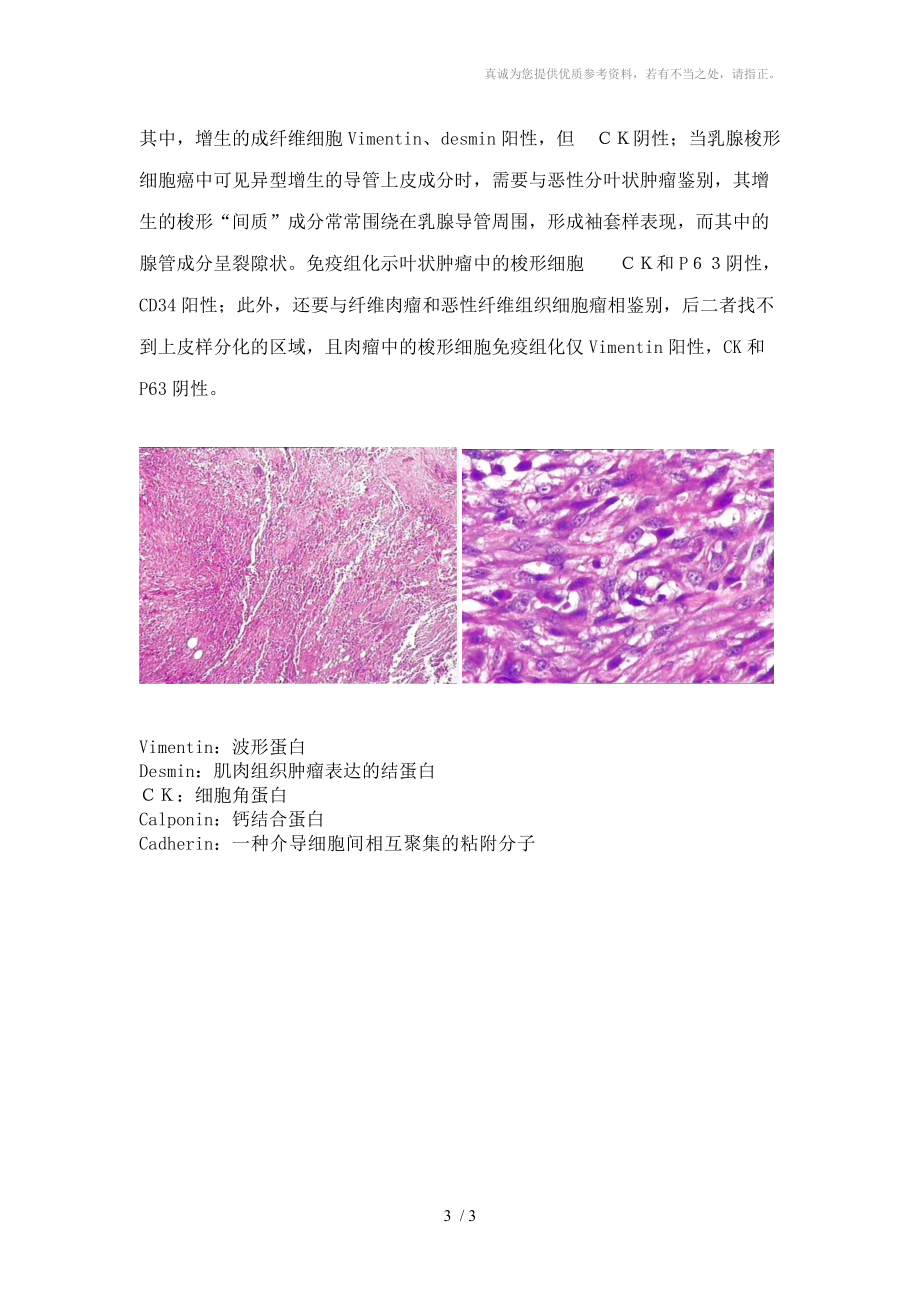 2012年梭形细胞肿瘤讨论分享.doc_第3页