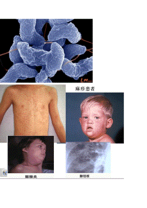 传染病图片.pdf