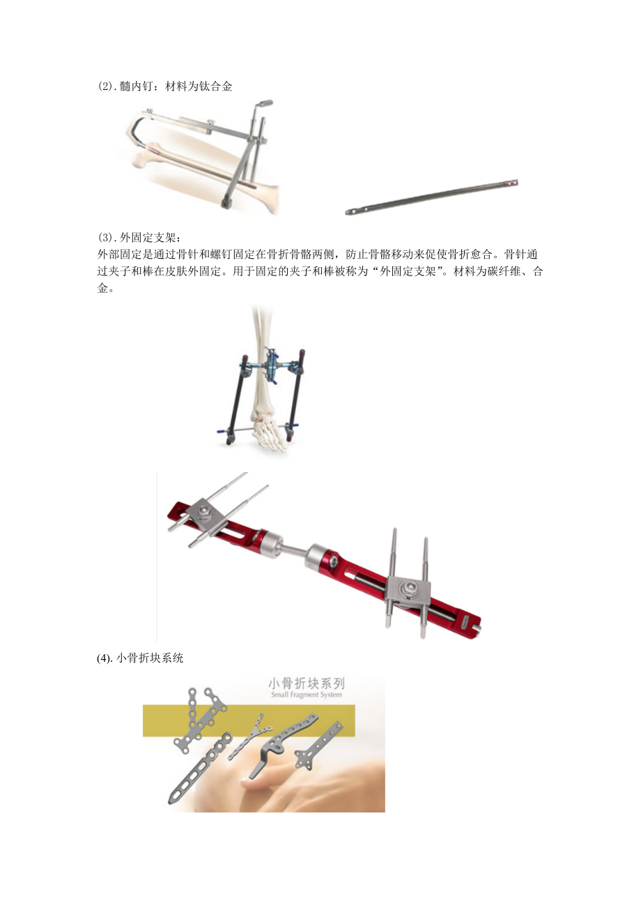 （精选）骨科器械种类概述.doc_第2页