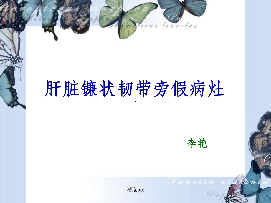 肝脏镰状韧带旁假.ppt_第2页