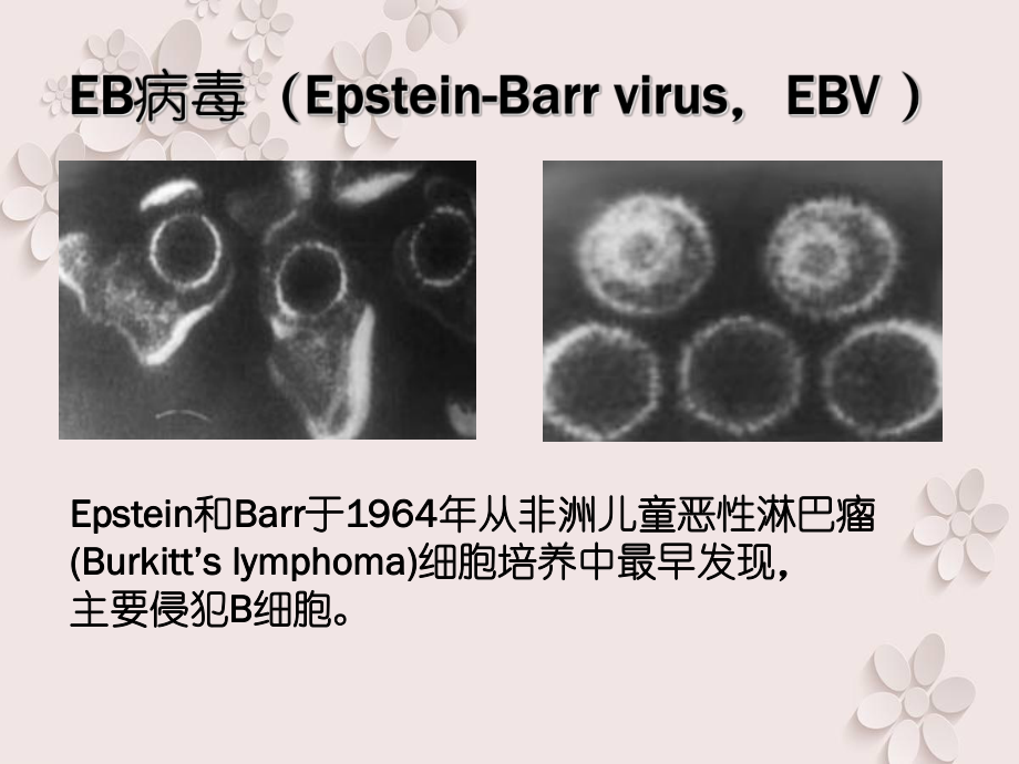儿童EB病毒感染--儿科业务学习.ppt_第3页